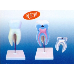 Magnified Incisor Tooth Model