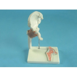Hip Joint Model with Tendons
