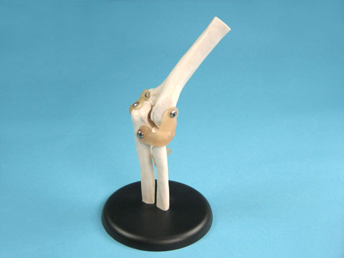 Elbow Joint Model