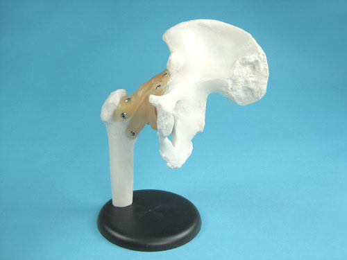 Hip Joint Model