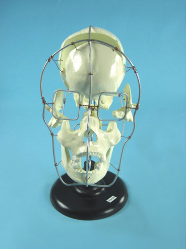 Partial Human Skull Model