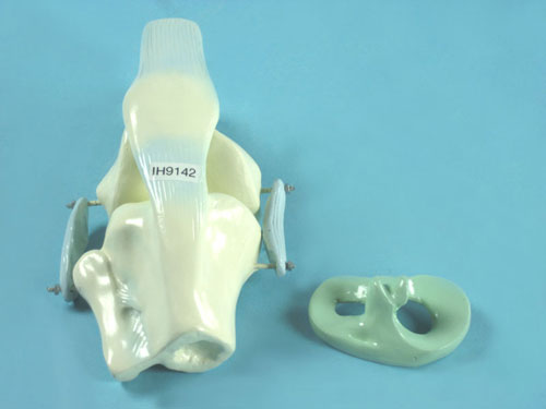 Knee Joint Model with Tendons