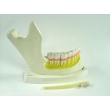 Teeth and Jawbone Structure Model