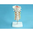 Model of the Upper Spine to the Occipital Bone