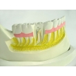 Teeth and Jawbone Structure Model