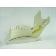 Teeth and Jawbone Structure Model