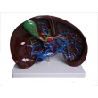 Liver Dissection Model