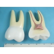 Teeth Model Set