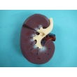 Human Kidney Model