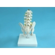 Model of the Pelvis with Lumbar Bones