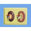 Structure of the Kidney, Bas Relief Model