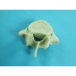 Vertebrae Bone Model Set