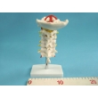 Model of the Upper Spine to the Occipital Bone